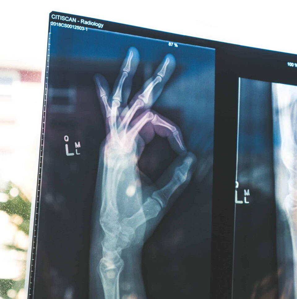 Röntgenbild einer Hand, die das Ok-Zeichen gibt