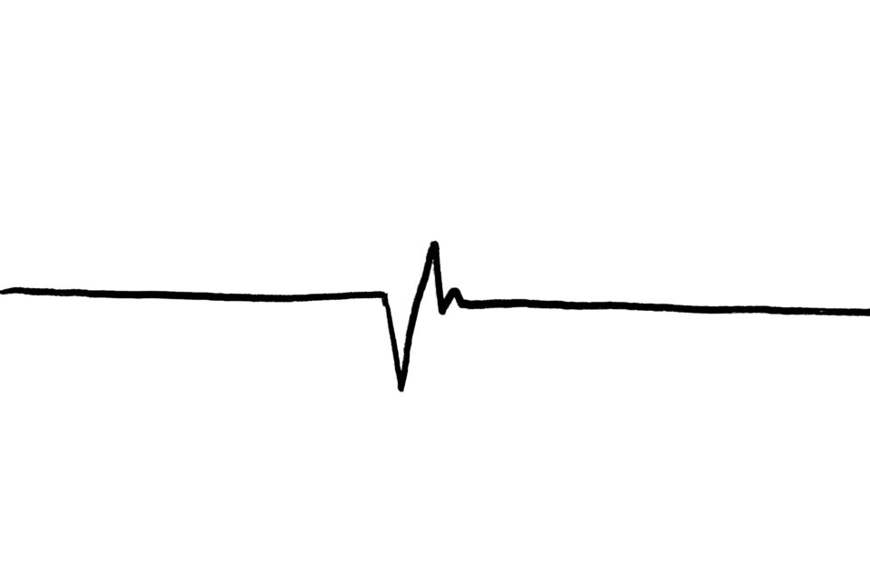 Die bildliche Darstellung des menschlichen Herzschlags, wie man sie von Krankenhausmonitoren kennt.