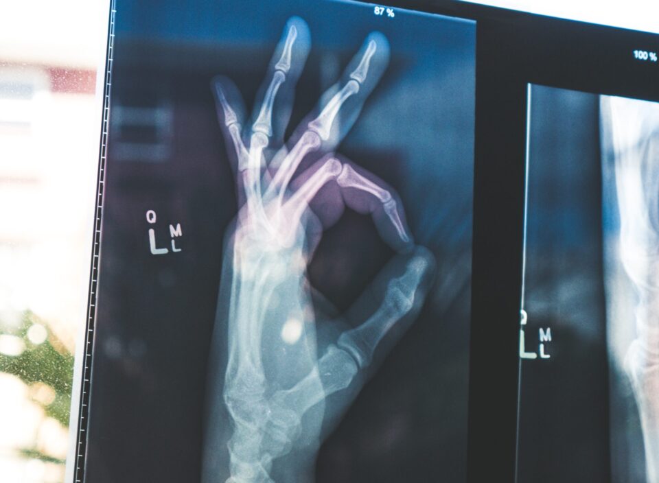 Ein Ultraschall von einer Hand, die das OK-Zeichen gibt