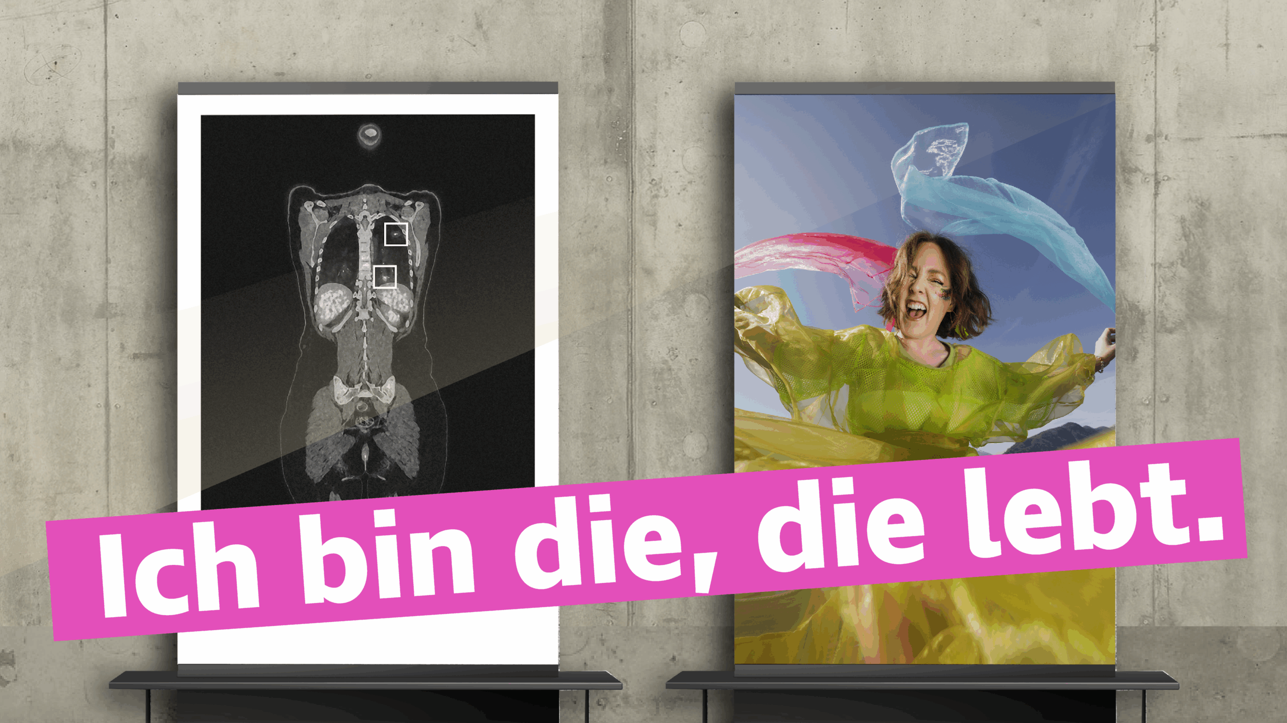 Wir sind die, die leben.