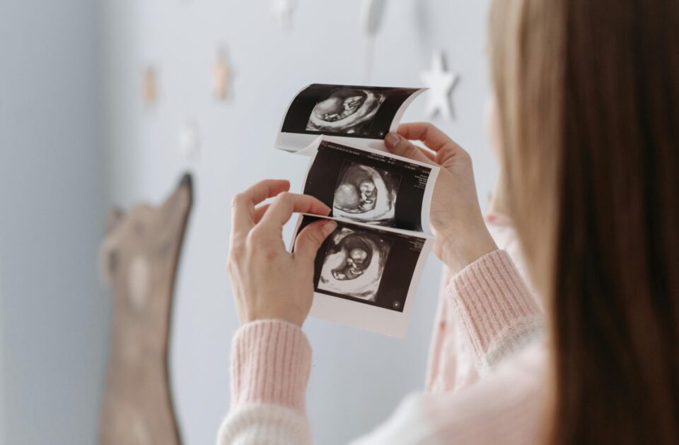 Frau hält Ultraschallbilder von Baby